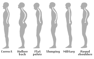 posture types - side view