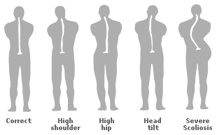 posture types - back view